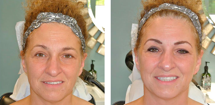Before and After - Eyebrows & Eyes