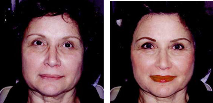 Before and After - Eyes, Eyebrows & Lips