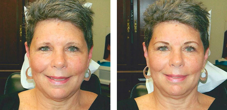 Before and After Photo - Permanent Cosmetics of Maryland